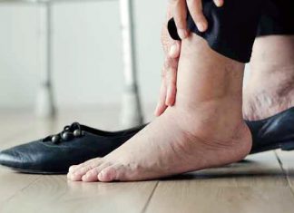 ডায়াবেটিস হলে পায়ের যত্ন নেবেন যেভাবে