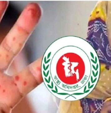 হাম ও হামের উপসর্গ নিয়ে ১৬ জনের মৃত্যু