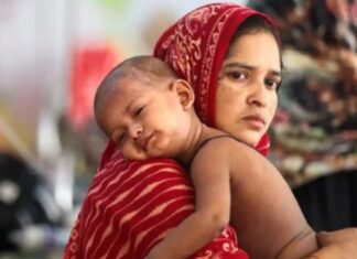 হাম উপসর্গে ৪ মৃত্যু, আক্রান্ত ১,০৯৭
