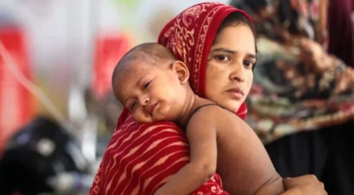 হাম উপসর্গে ৪ মৃত্যু, আক্রান্ত ১,০৯৭